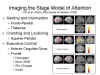 Imaging the Stage Model of Attention