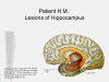 29HMhippocampus.gif (41744 bytes)