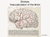 Strokes: Vascularization of the Brain
