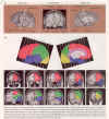 Brain Slices MRI