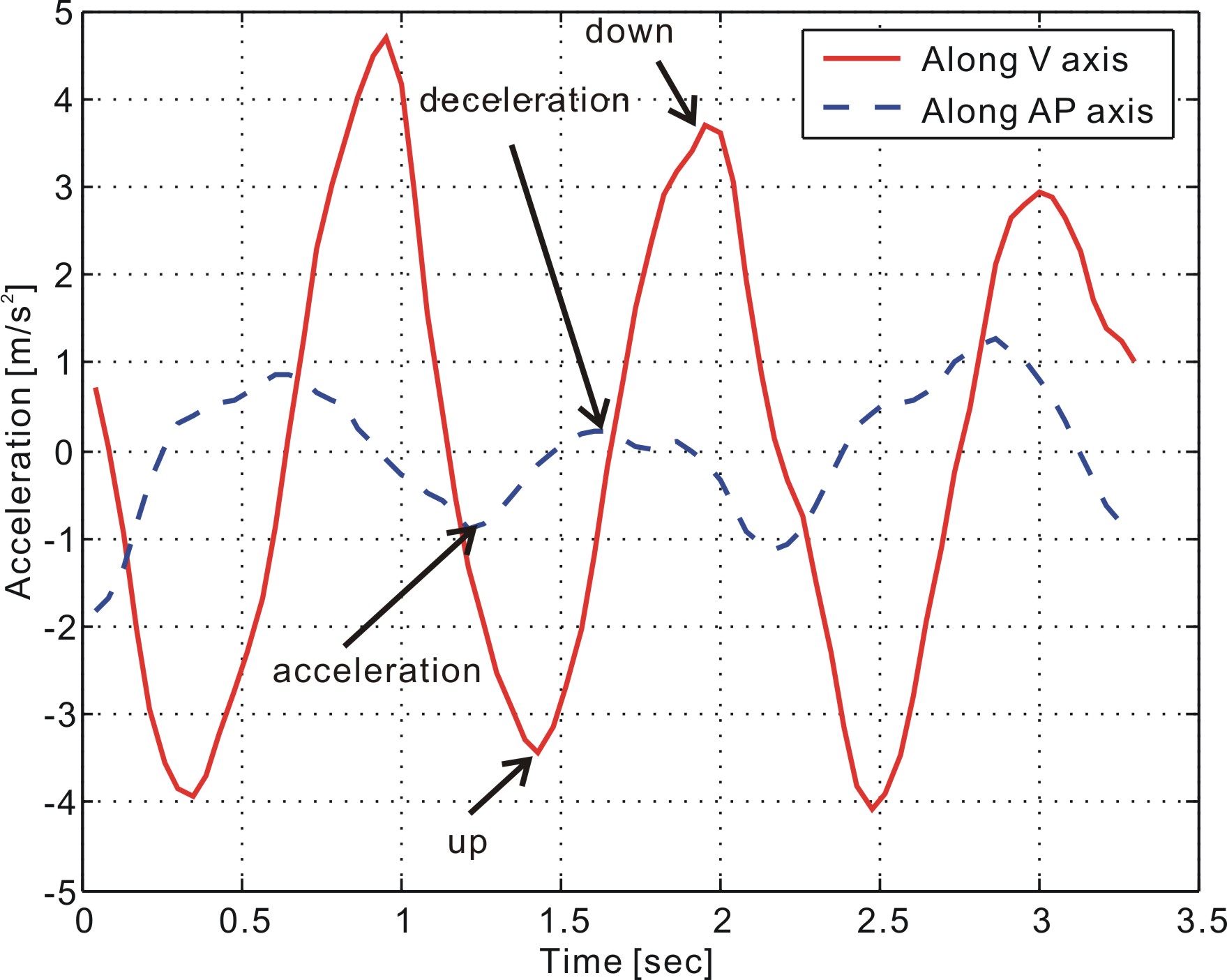 AP and V acceleration pattern